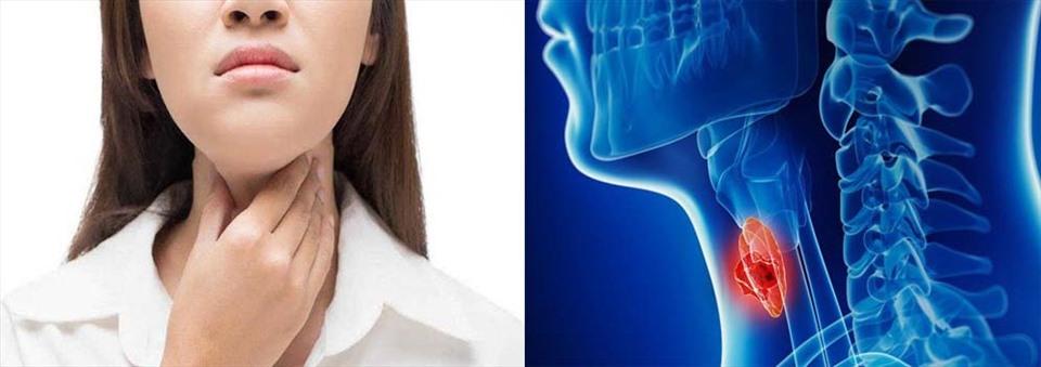 Những dấu hiệu nhận biết căn bệnh ung thư hạ họng lastest-news
